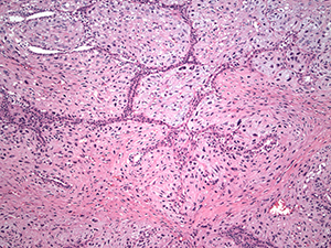 Breast Pathology Slide Image