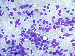 Cytopathology slide image