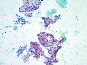 Cytopathology slide image