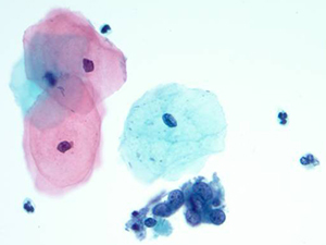 Cytopathology slide image