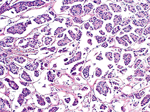 Genitourinary pathology slide