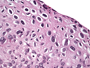 Gynecologic pathology slide