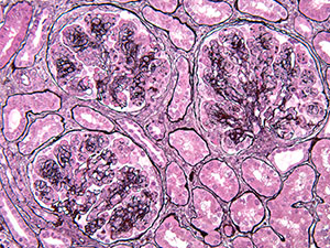 Medical Kidney Pathology slide image