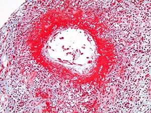 Medical Kidney Pathology slide image